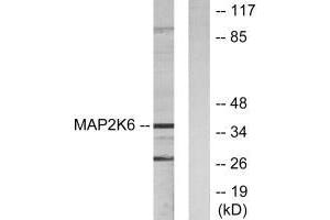 Western blot analysis of extracts from 293 cells, using MAP2K6 antibody. (MAP2K6 Antikörper  (N-Term))