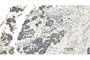IHC analysis of IDH2 using anti-IDH2 antibody (ABIN7602787).