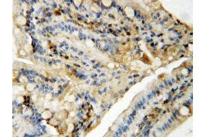 Anti-MAPK8/9 antibody, IHC(P) IHC(P): Rat Intestine Tissue (JNK Antikörper  (Middle Region))