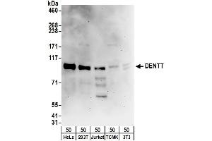 anti-TSPY-Like 2 (TSPYL2) (AA 1-50) antibody