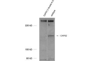 Western Blotting (WB) image for anti-Calcyphosine 2 (CAPS2) (AA 15-89) antibody (ABIN1742521) (Calcyphosine 2 Antikörper  (AA 15-89))