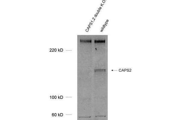 Calcyphosine 2 Antikörper  (AA 15-89)