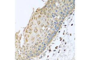 Immunohistochemistry of paraffin-embedded human esophagus using ARFGAP3 antibody at dilution of 1:100 (x40 lens). (ARFGAP3 Antikörper)