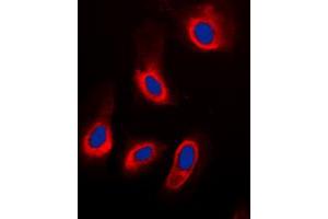 Immunofluorescent analysis of ADPGK staining in HeLa cells. (ADPGK Antikörper  (Center))