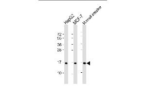 All lanes : Anti-COXIV Isoform 2 Antibody at 1:2000 dilution Lane 1: HepG2 whole cell lysate Lane 2: MCF-7 whole cell lysate Lane 3: mouse small intestine lysate Lysates/proteins at 20 μg per lane. (COX IV Antikörper  (Isoform 2))