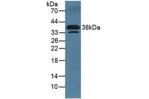 Figure. (DKK3 Antikörper  (AA 23-349))