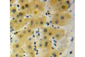 Used in DAB staining on fromalin fixed paraffin-embedded Liver tissue (HSPB2 Antikörper  (AA 12-170))