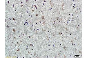 Formalin-fixed and paraffin embedded rat brain labeled with Anti-PLAUR Polyclonal Antibody, Unconjugated (ABIN675443) at 1:200 followed by conjugation to the secondary antibody and DAB staining