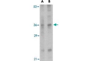 Western blot analysis of IL33 in human lymph node tissue lysate with IL33 polyclonal antibody  at (A) 1 and (B) 2 ug/mL . (IL-33 Antikörper  (Internal Region))