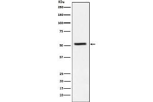 Western blot analysis of TrpRS expression in HeLa cell lysate.