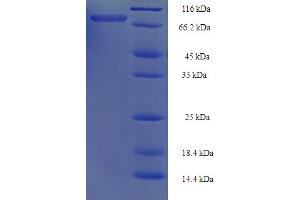 SDS-PAGE (SDS) image for TNF Receptor-Associated Factor 5 (TRAF5) (AA 1-557), (full length) protein (His-SUMO Tag) (ABIN5710548) (TRAF5 Protein (AA 1-557, full length) (His-SUMO Tag))