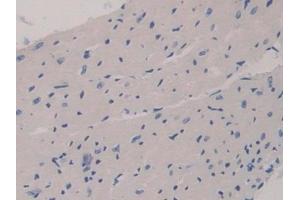 Immunohistochemistry (IHC) image for anti-GRB2-Associated Binding Protein 3 (GAB3) (AA 142-375) antibody (ABIN7443473)