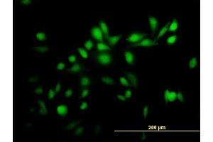 Immunofluorescence of purified MaxPab antibody to TRIM39 on HeLa cell.