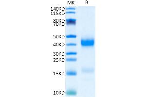 Human Azurocidin on Tris-Bis PAGE under reduced condition. (Azurocidin Protein (His tag))