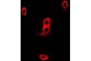 Immunofluorescent analysis of p67 phox staining in Hela cells. (NCF2 Antikörper)
