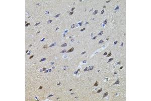 Immunohistochemistry of paraffin-embedded rat brain using PLK4 antibody. (PLK4 Antikörper)