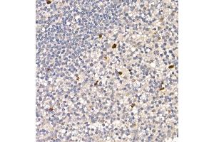 Immunohistochemistry of paraffin-embedded human tonsil using NUR77 Rabbit pAb (ABIN6132395, ABIN6144826, ABIN6144829 and ABIN6222380) at dilution of 1:100 (40x lens). (NR4A1 Antikörper  (AA 1-170))