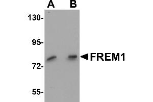 Western Blotting (WB) image for anti-FRAS1 Related Extracellular Matrix 1 (FREM1) (C-Term) antibody (ABIN1030402) (FREM1 Antikörper  (C-Term))