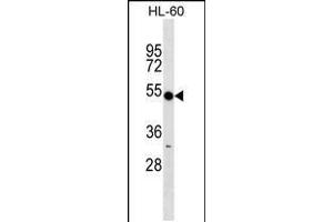 Western blot analysis in HL-60 cell line lysates (35ug/lane). (RNF14 Antikörper  (C-Term))