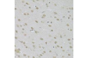 Immunohistochemistry of paraffin-embedded mouse brain using JMJD6 Antibody (ABIN5973452) at dilution of 1/100 (40x lens). (JMJD6 Antikörper)