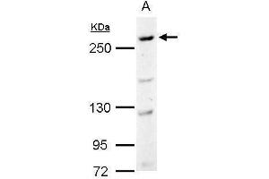 WB Image CAD antibody [C2C3], C-term detects CAD protein by Western blot analysis. (CAD Antikörper  (C-Term))