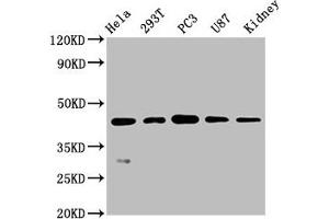 Western Blot Positive WB detected in: Hela whole cell lysate, 293T whole cell lysate, PC3 whole cell lysate, U87 whole cell lysate, Mouse kidney tissue All lanes: NDRG1 antibody at 0. (Rekombinanter NDRG1 Antikörper)
