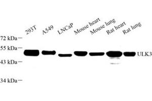 Western blot analysis of ULK3 (ABIN7076150) at dilution of 1: 1000 (ULK3 Antikörper)