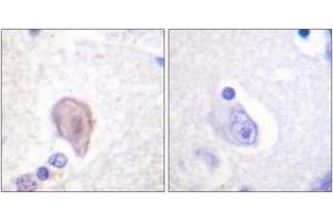 Immunohistochemistry analysis of paraffin-embedded human brain tissue, using C-RAF (Ab-43) Antibody. (RAF1 Antikörper  (AA 11-60))