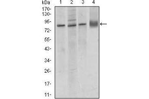 Western blot analysis using CDH5 mouse mAb against MCF-7 (1), A549 (2), HUVE-12 (3) cell lysate, and rat lung (4) tissue lysate. (Cadherin 5 Antikörper  (AA 29-223))