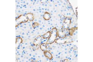 Immunohistochemistry (IHC) image for anti-Apolipoprotein M (APOM) (AA 23-188) antibody (ABIN6137030)