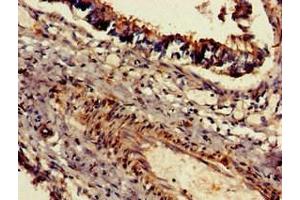 Immunohistochemistry of paraffin-embedded human lung tissue using ABIN7150873 at dilution of 1:100 (Dnah5 Antikörper  (AA 2364-2560))