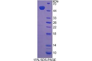 Image no. 1 for Coenzyme Q10 Homolog B (COQ10B) (AA 38-238) protein (His tag,GST tag) (ABIN6236512)