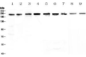 Western blot analysis of BRG1 using anti-BRG1 antibody . (SMARCA4 Antikörper  (AA 555-763))