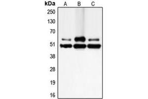 Western blot analysis of c-FLIP expression in Jurkat (A), SW480 (B), K562 (C) whole cell lysates. (FLIP Antikörper  (N-Term))