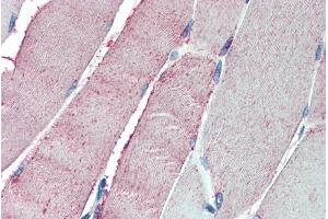 ABIN185115 (5µg/ml) staining of paraffin embedded Human Skeletal Muscle. (OSBPL1A Antikörper  (C-Term))