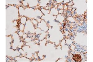 ABIN6267576 at 1/200 staining Mouse lung tissue sections by IHC-P.