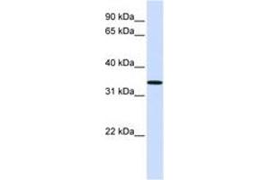 Image no. 1 for anti-Chromosome 16 Open Reading Frame 78 (C16orf78) (AA 108-157) antibody (ABIN6741159) (C16orf78 Antikörper  (AA 108-157))