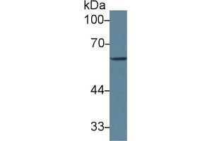 Detection of GAD1 in Mouse Cerebrum lysate using Polyclonal Antibody to Glutamate Decarboxylase 1, Brain (GAD1) (GAD Antikörper  (AA 1-97))