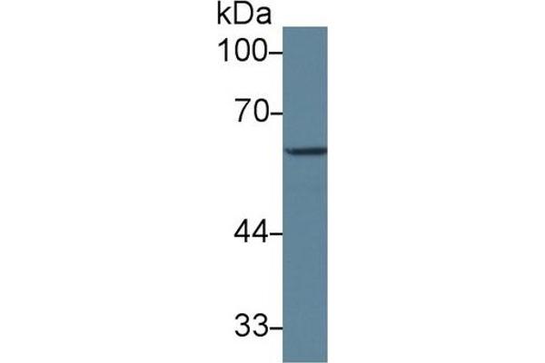 GAD Antikörper  (AA 1-97)