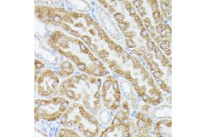 Immunohistochemistry of paraffin-embedded mouse kidney using  antibody (ABIN6131166, ABIN6136417, ABIN6136418 and ABIN6223845) at dilution of 1:100 (40x lens). (ACAT2 Antikörper  (AA 1-97))