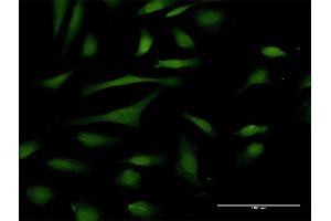 Immunofluorescence of purified MaxPab antibody to PIN4 on HeLa cell.