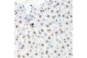 Immunohistochemistry of paraffin-embedded rat liver using PTBP1 antibody. (PTBP1 Antikörper  (AA 1-100))