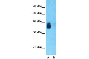Western Blotting (WB) image for anti-CD36 (CD36) (N-Term) antibody (ABIN2783229)