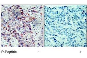 Image no. 1 for anti-Mitogen-Activated Protein Kinase Kinase 4 (MAP2K4) (pSer80) antibody (ABIN196910) (MAP2K4 Antikörper  (pSer80))