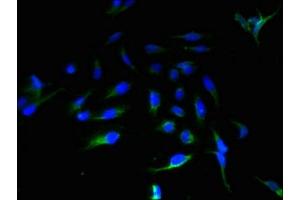 Immunofluorescent analysis of Hela cells using ABIN7143952 at dilution of 1:100 and Alexa Fluor 488-congugated AffiniPure Goat Anti-Rabbit IgG(H+L) (ABHD14A Antikörper  (AA 56-258))