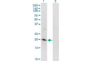 Western Blot analysis of ARL2BP expression in transfected 293T cell line by ARL2BP monoclonal antibody (M03), clone 2G6. (ARL2BP Antikörper  (AA 1-163))