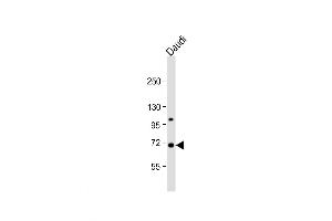 Western Blot at 1:1000 dilution + Daudi whole cell lysate Lysates/proteins at 20 ug per lane. (SIGLEC10 Antikörper  (C-Term))