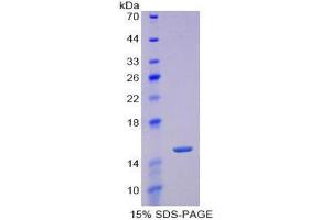 SDS-PAGE (SDS) image for Periostin (POSTN) (AA 370-494) protein (His tag) (ABIN1080494)