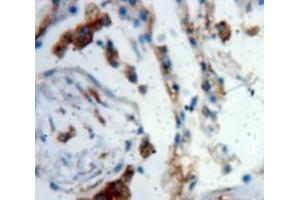 Used in DAB staining on fromalin fixed paraffin-embedded Lung tissue (LTBP2 Antikörper  (AA 522-814))