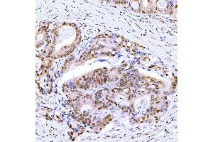 IHC analysis of Symplekin/SYMPK using anti-Symplekin/SYMPK antibody (ABIN7601558). (Symplekin Antikörper  (AA 384-1092))